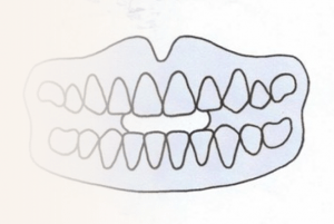 Orthodontiste Molsheim Dr Robert Positionneur