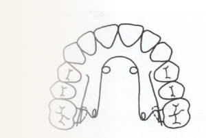 Orthodontiste Molsheim Dr Robert Quad Helix