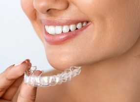 Orthodontiste Molsheim Dr Vincent Robert systeme invisible
