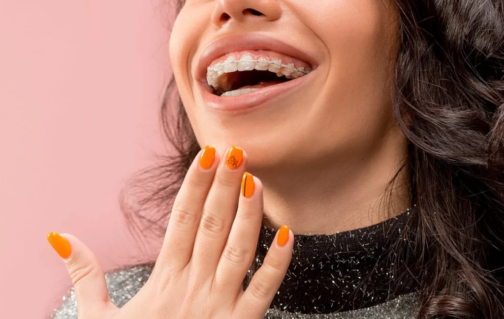 appareil dentaire molsheim ceramique appareil dentaire molsheim ceramique Orthodontiste près de Barr : aligneurs transparents et appareil multi-attaches au cabinet du Dr Robert Dr Vincent Robert | Orthodontiste à Molsheim