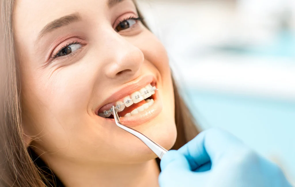 appareil dentaire molsheim discret appareil dentaire molsheim discret Orthodontiste près de Marlenheim : aligneurs transparents et appareil multi-attaches au cabinet du Dr Robert Dr Vincent Robert | Orthodontiste à Molsheim